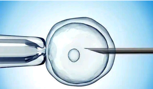 贵州捐卵实例 2023卵巢早衰贵州供卵不排队医院 ‘nt影像看男女’